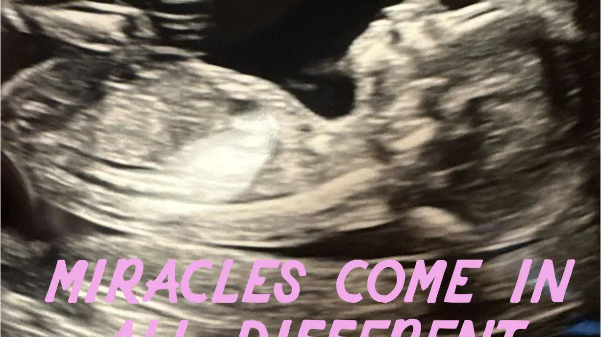 MIRACLES-COME-IN-ALL-DIFFERENT-WAYS-AND-SIZES Late Sunday Afternoon
