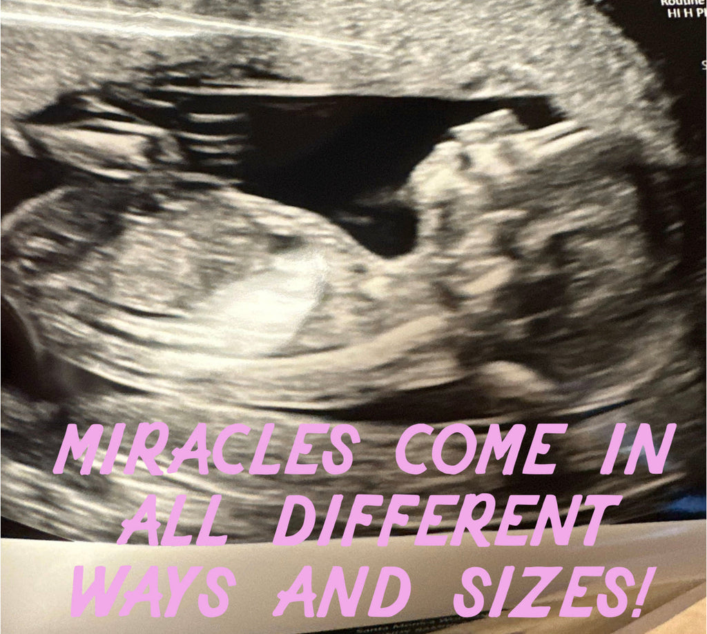MIRACLES COME IN ALL DIFFERENT WAYS AND SIZES